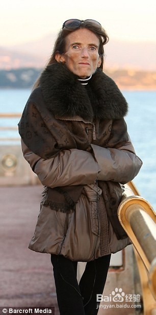 世界第一瘦女子讲述减肥危害