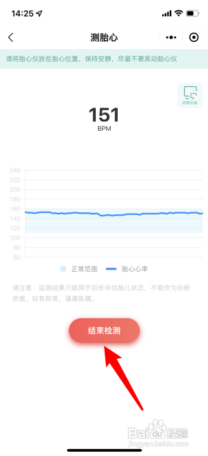 海尔胎心仪怎么连接手机