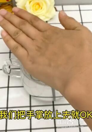 手指扎刺怎么办