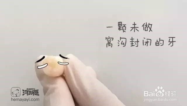 什么是窝沟封闭,为什么要做窝沟封闭?