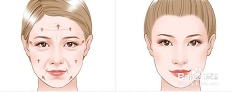 面部提升价格需多少？