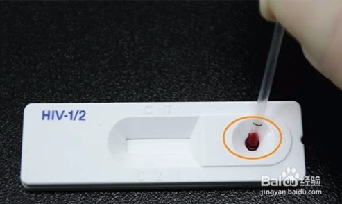 艾滋病HIV自我检测如何才准确