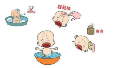 如何保护婴儿囟门