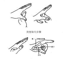 胃酸过多怎么办