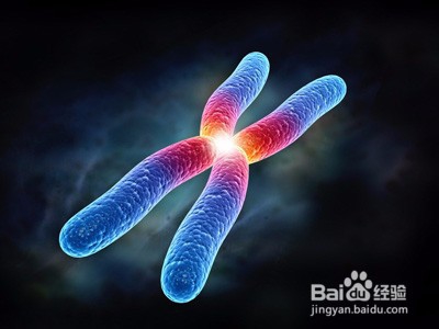 帕金森病是如何形成的呢