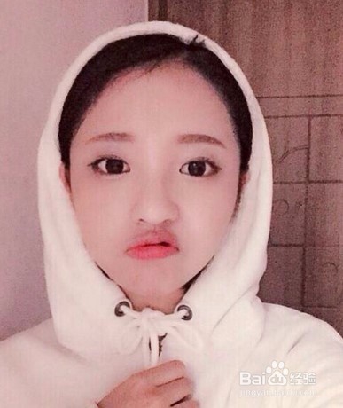 宝宝中暑后，家长第一时间怎么做呢？