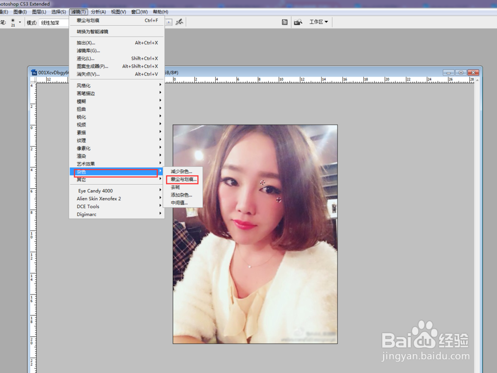 如何去除脸上的痦子?