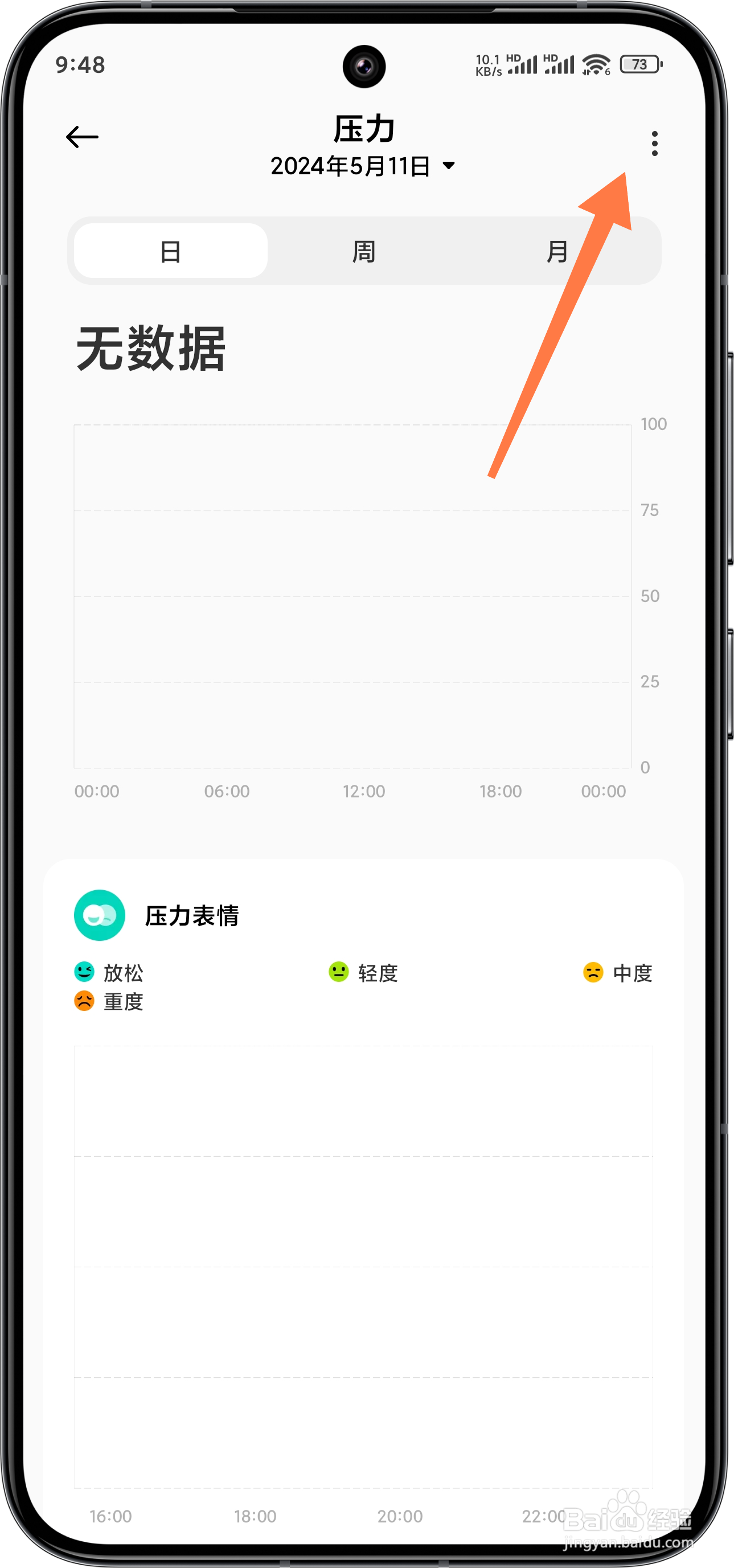 小米运动健康怎么开启压力监测