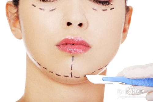 去韩国整容需要注意什么 赴韩整形注意事项