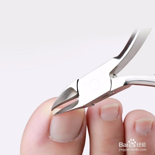 令人头疼的甲沟炎如何预防