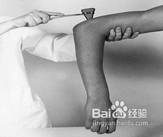 关注健康 血小板增多症的症状有哪些