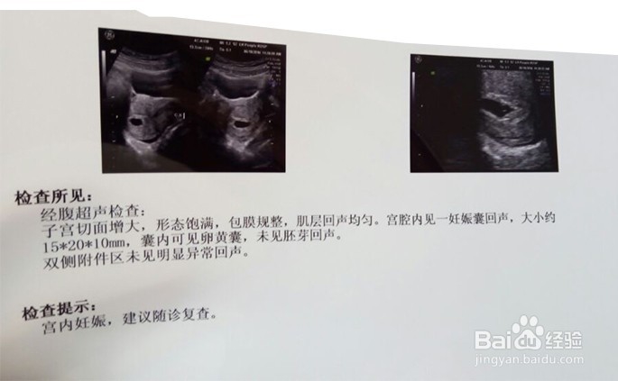 孕前三个月要注意什么