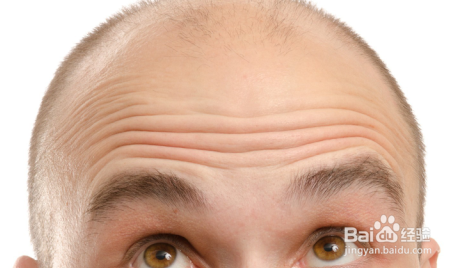 冬季治疗脱发经验和生发方法