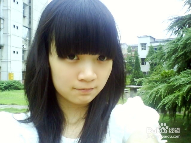 女性斑秃的治疗方法