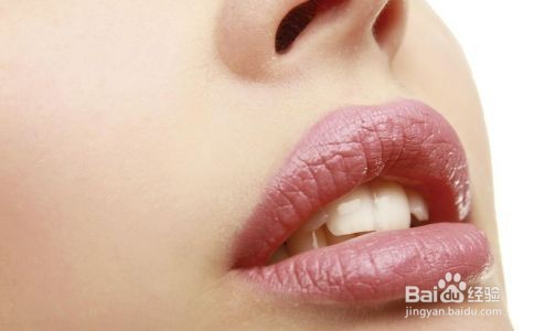 冬季的时候嘴唇出现干裂脱皮解决的好办法