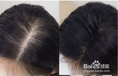 怎么增发最有效