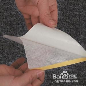 贴膏药的胶印怎么去除