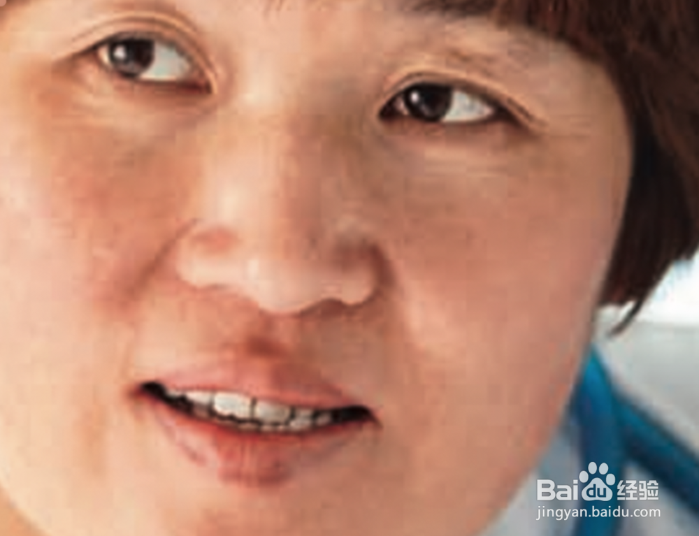 怎么P掉脸上的痣