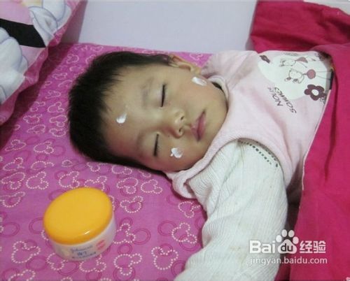 妈咪经验分享:宝宝冬季皮肤护理方法