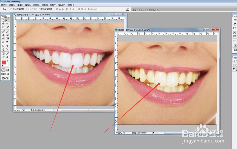 怎样用PS将人物照片中发黄的牙齿变白？