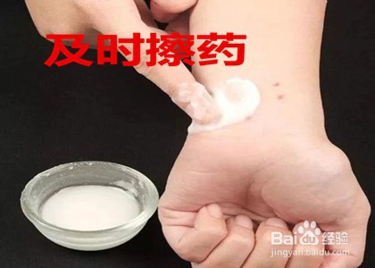 被猫身上的虫子咬了怎么办