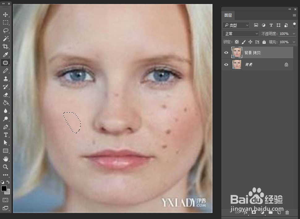 如何利用ps简单去除明显痘痘