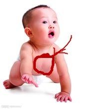 小孩突发高烧怎么办