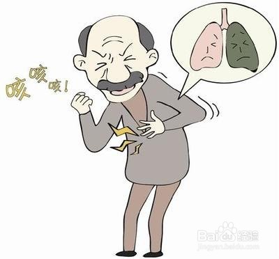 如何才能发现间质性肺炎早期症状