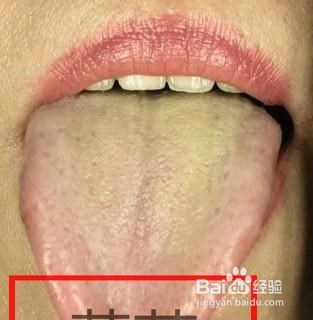 中医胃症有哪几个类型、其主要临床表现是什么