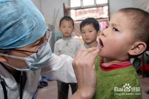 预防手足口病方法?