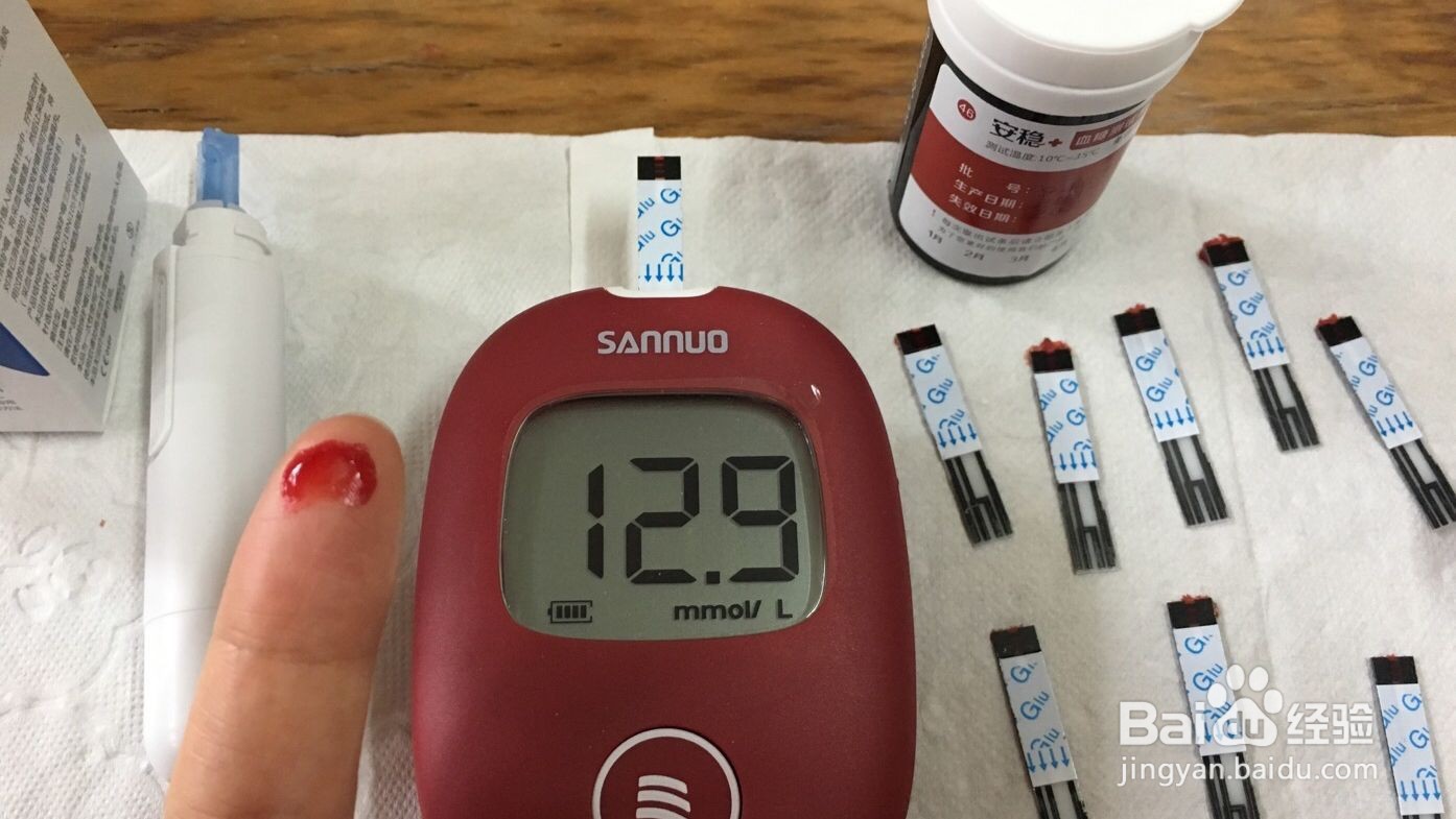 怎样拔智齿佩戴隐形牙套