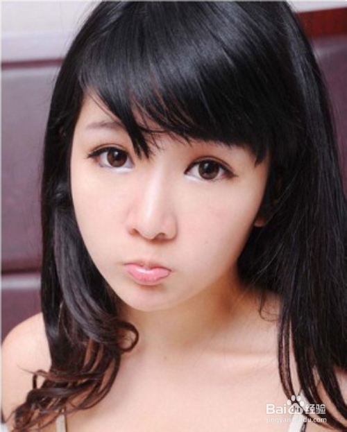 埋线双眼皮几天消肿