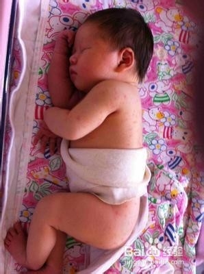 哪些事会加速皮肤衰老