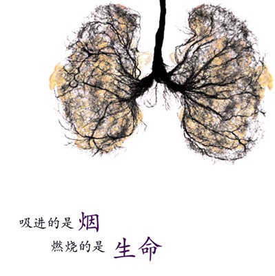 了解肺癌的病因