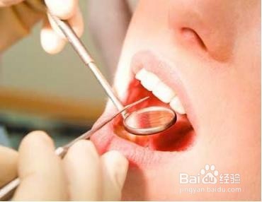 如何选择功效型牙膏?