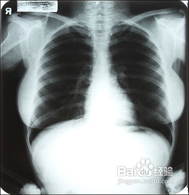 特殊环境人员的体检项目注意事项