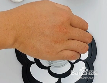 手指扎刺怎么办,不可以用针去挑