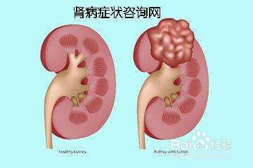 肌酐偏低是为什么?