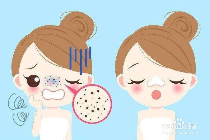 去黑头的方法都有哪些