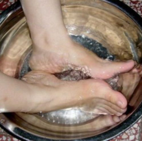 防治牛皮癣的保健工作