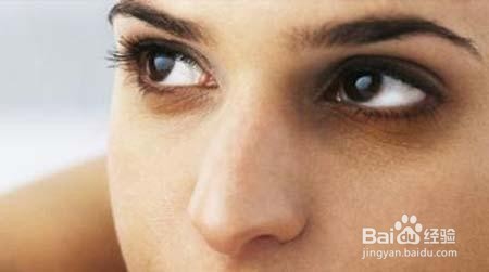 如何正确去除眼袋