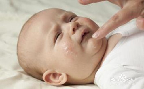 婴儿口水疹怎么办