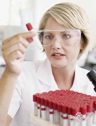 妇科常规体检项目有哪些