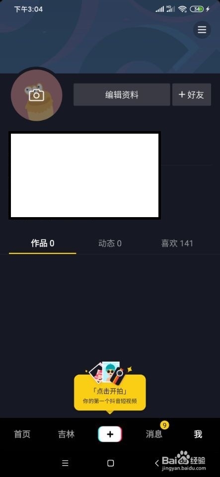 抖音如何设置谁可以看我的关注、粉丝列表