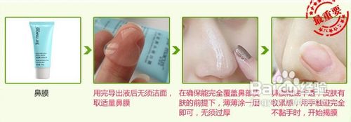 怎么才能去除黑头