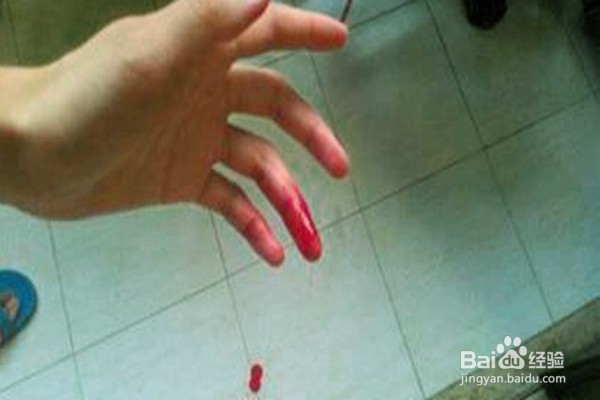 孩子受伤后怎样处理？