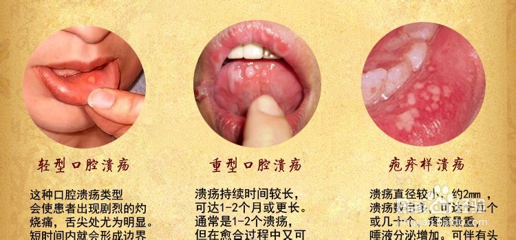 饮茶对人体的弊与利