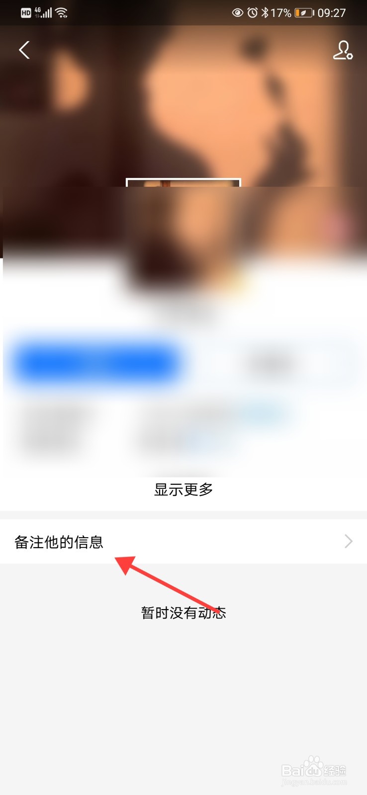支付宝好友名字怎么备注