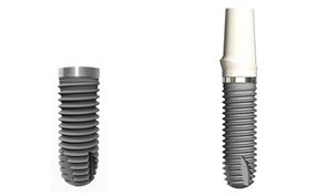 种植牙过程是怎么样的