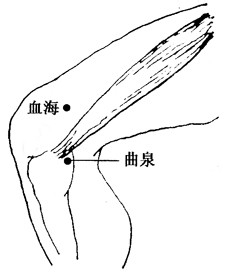 百病刮痧：[44]带状疱疹的刮痧疗法